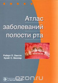Скачать книгу "Атлас заболеваний полости рта, Роберт П. Лангле, Крэйг С. Миллер"