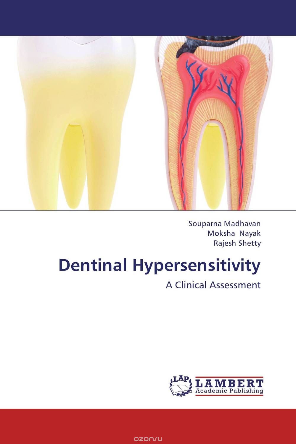Скачать книгу "Dentinal Hypersensitivity"