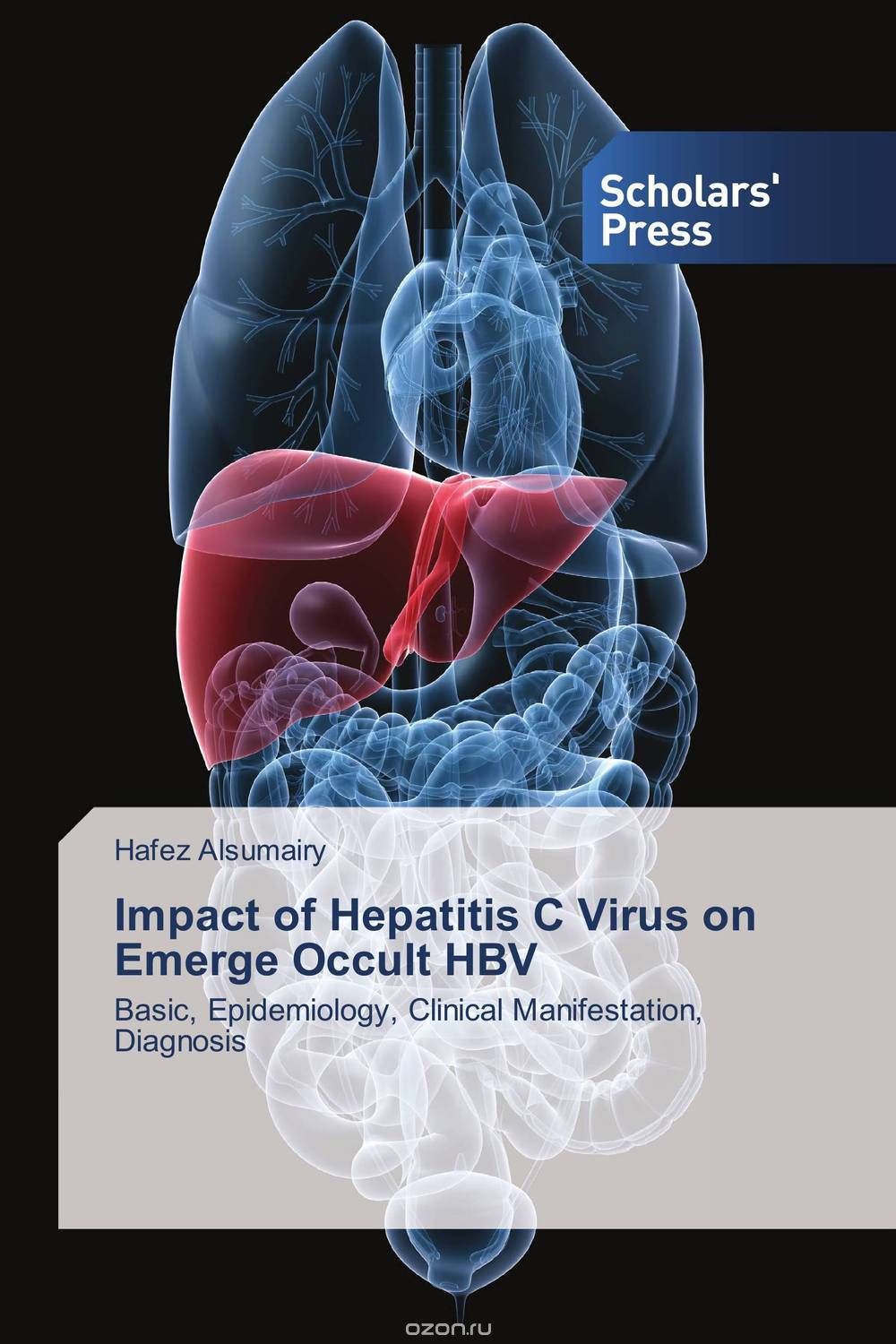 Скачать книгу "Impact of Hepatitis C Virus on Emerge Occult HBV"